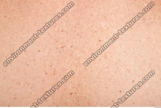 photo texture of white skin 0022